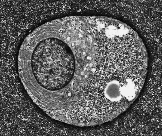 Electron micrograph of a typical articular chondrocyte